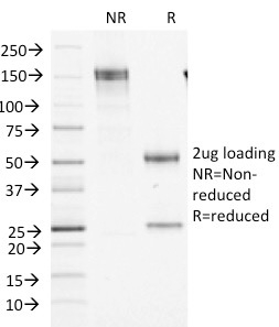 Data from SDS-PAGE analysis of Anti-Factor XIIIa antibody (Clone F13A1/1448). Reducing lane (R) shows heavy and light chain fragments. NR lane shows intact antibody with expected MW of approximately 150 kDa. The data are consistent with a high purity, intact mAb.